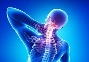 complicaciones probables con una unión de osteocondrosis