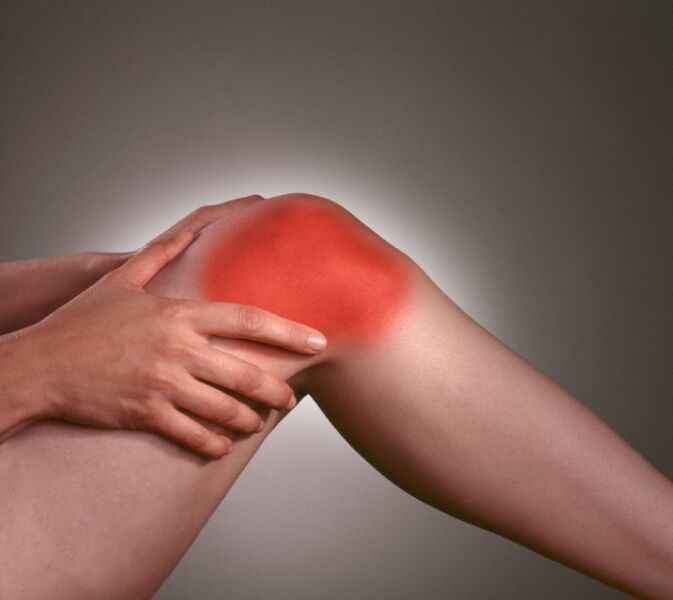 Inflamación en la articulación de la rodilla con artrosis