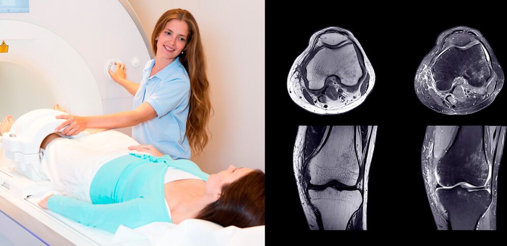 diagnóstico de la articulación de la rodilla