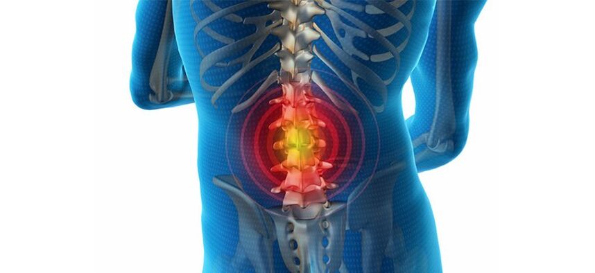 métodos para diagnosticar el dolor de espalda